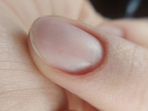 MACRO LENS - Slika 37